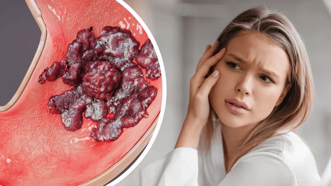 Rak żołądka objawy forum: Jak rozpoznać niebezpieczne symptomy?