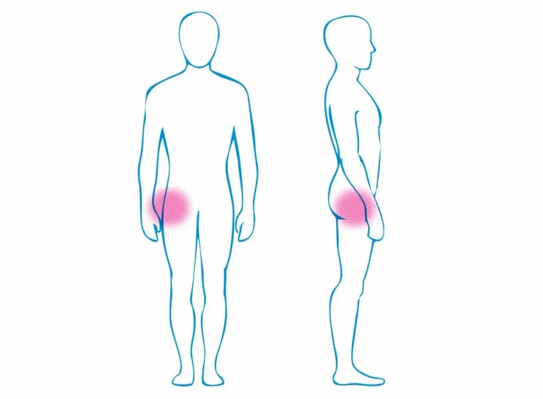 Objawy stawu biodrowego: jak rozpoznać ból i unikać problemów