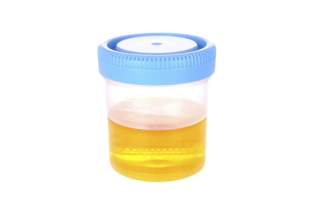 Ile ml moczu potrzebujesz do badania? Sprawdź wymagania laboratoryjne