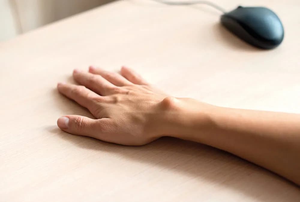 Ganglion do jakiego lekarza? Odpowiedni specjalista na wagę zdrowia