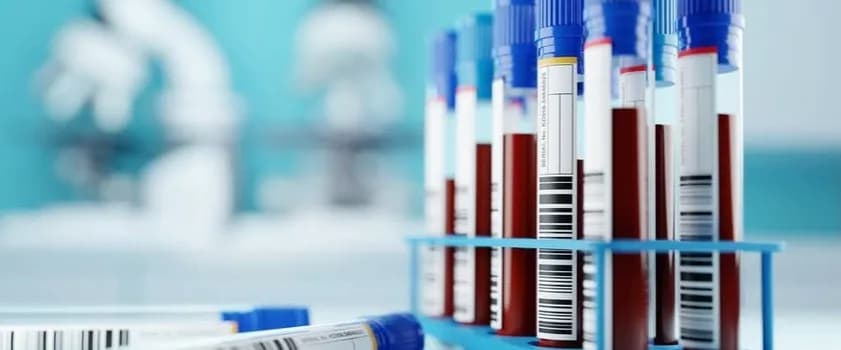 Ile się czeka na wynik badania INR? Oto co musisz wiedzieć