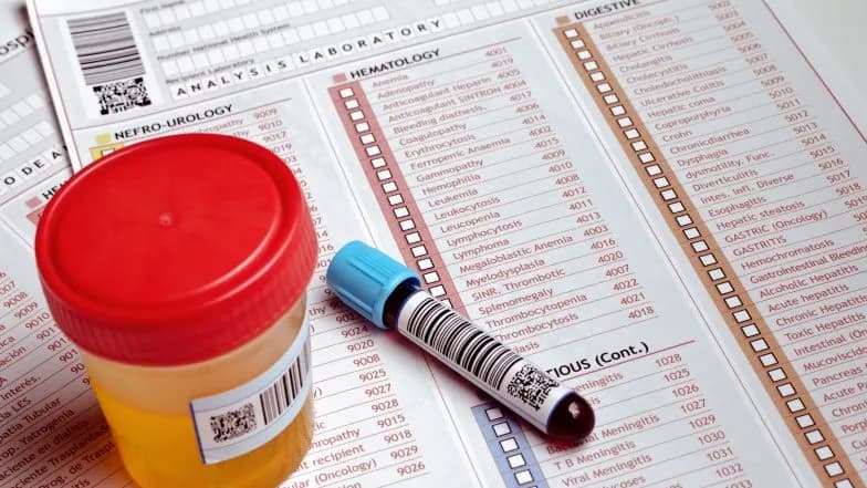 Jaka ilość moczu do badania? Kluczowe informacje, które musisz znać