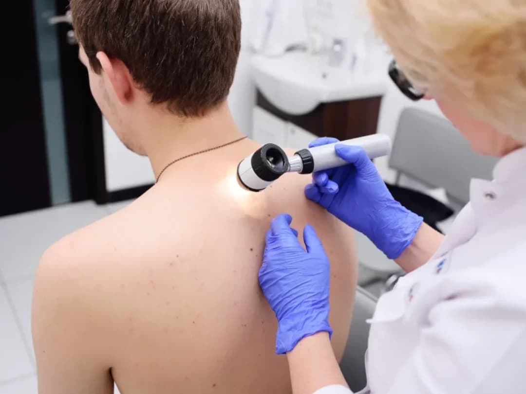 Tłuszczak do jakiego lekarza? Sprawdź, jak uzyskać pomoc medyczną